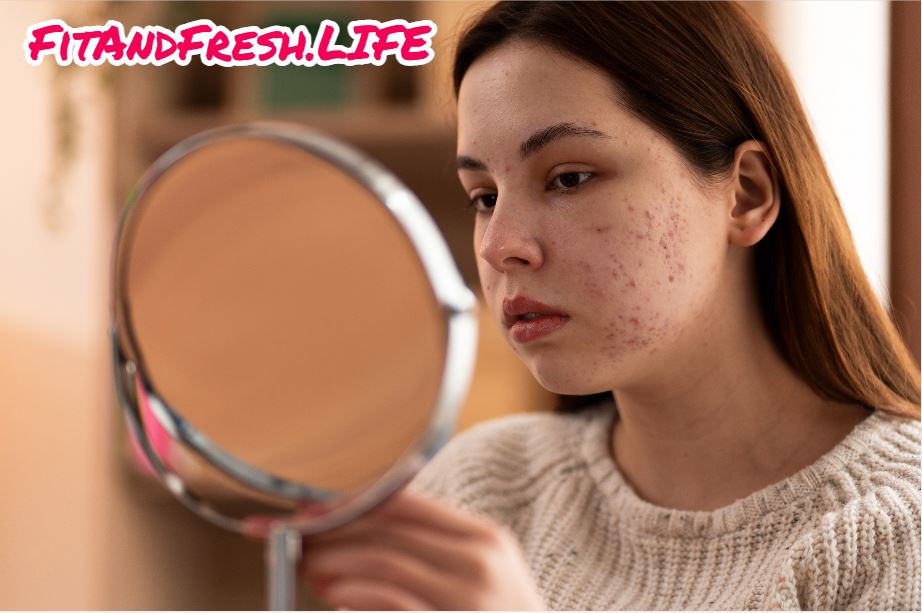 A girl see's her acne face on mirror